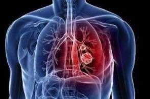 全国已有新型肺炎确诊病例共440例 死亡9例